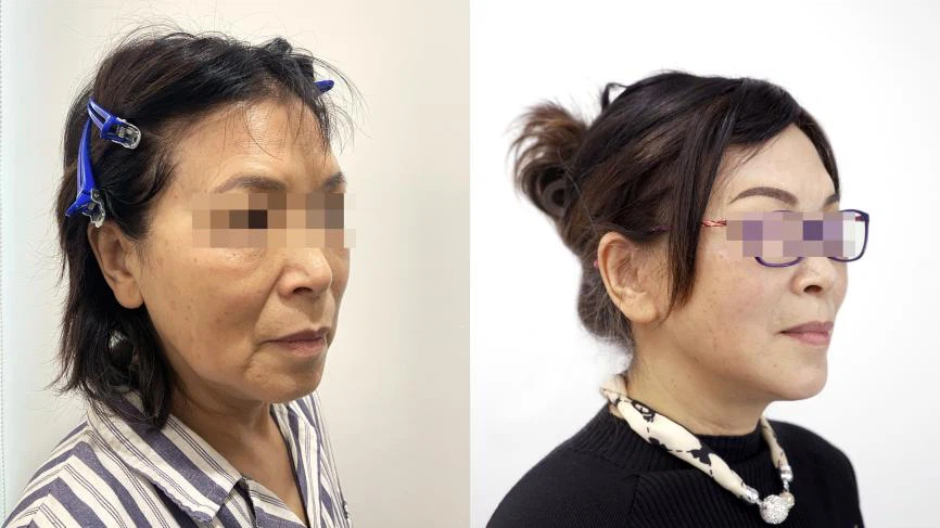 product-866-487 product-866-487