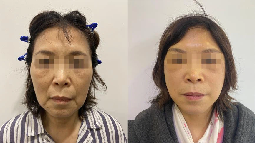 product-866-487 product-866-487