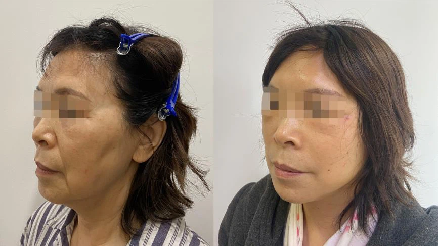 product-866-487 product-866-487